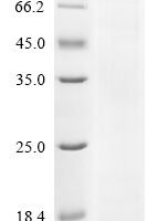 Severe acute respiratory syndrome coronavirus 2 Nucleoprotein (N) (P13L,Δ31-33,R203K,G204R) Recombinant Protein - BioCrest Sci