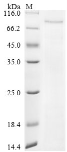 Severe acute respiratory syndrome coronavirus 2 Nucleoprotein (N) (P13L,Δ31-33,R203K,G204R) Recombinant Protein, Severe acute respiratory syndrome coronavirus 2 (2019-nCoV) (SARS-CoV-2), Yeast, N-terminal 6xHis-PDI-tagged, 104.1 kDa, purity >≥ 90% as determined by SDS-PAGE.