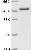 Human Calcium-binding and coiled-coil domain-containing protein 2 (CALCOCO2) Recombinant Protein, C-His - BioCrest Sci