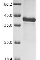 Human Insulin-like growth factor-binding protein 5 (IGFBP5) Recombinant Protein - BioCrest Sci