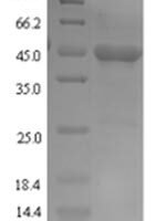 Naja kaouthia Cobra venom factor, partial Recombinant Protein - BioCrest Sci