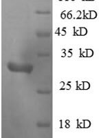 Mouse Mitogen-activated protein kinase kinase kinase 1 (Map3k1), partial Recombinant Protein - BioCrest Sci