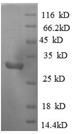 Mouse Mitogen-activated protein kinase kinase kinase 1 (Map3k1), partial Recombinant Protein, Mus musculus (Mouse), E.coli, N-terminal 6xHis-tagged, 34.8 kDa, purity >≥ 90% as determined by SDS-PAGE.