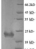 Bordetella pertussis Serotype 2 fimbrial subunit (fim2) Recombinant Protein, N-His, aa 27–207, Yeast - BioCrest Sci