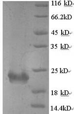 Bordetella pertussis Serotype 2 fimbrial subunit (fim2) Recombinant Protein, N-His, aa 27–207, Yeast, Bordetella pertussis (strain Tohama I / ATCC BAA-589 / NCTC 13251), Yeast, N-terminal 6xHis-tagged, 21.2 kDa, purity >≥ 90% as determined by SDS-PAGE.