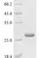 Human Dehydrogenase/reductase SDR family member 4-like 2 (DHRS4L2) Recombinant Protein - BioCrest Sci