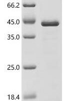 Mouse Alpha-actinin-4 (Actn4), partial Recombinant Protein - BioCrest Sci