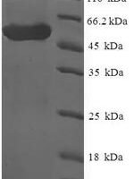 Human Sex comb on midleg-like protein 4 (SCML4) Recombinant Protein - BioCrest Sci