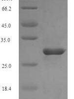 Mouse Complement receptor type 2 (Cr2), partial Recombinant Protein, N-His, aa 729–963, E.coli - BioCrest Sci