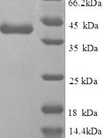 Human Replication protein A 14 kDa subunit (RPA3), partial Recombinant Protein - BioCrest Sci
