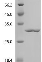 Hevea brasiliensis Small rubber particle protein (SRPP) Recombinant Protein - BioCrest Sci