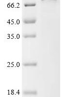Human Keratin,type II cytoskeletal 6A (KRT6A) Recombinant Protein - BioCrest Sci