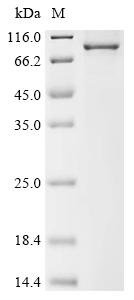 Human Keratin,type II cytoskeletal 6A (KRT6A) Recombinant Protein, Homo sapiens (Human), E.coli, C-terminal GST-tagged, 91.5 kDa, purity >≥ 85% as determined by SDS-PAGE.