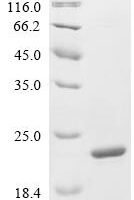 Vibrio cholerae serotype O1 Cholera toxin transcriptional activator (toxR), partial Recombinant Protein - BioCrest Sci