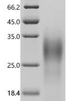 Human Glycophorin-A (GYPA), partial Recombinant Protein - BioCrest Sci