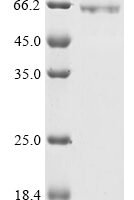 Escherichia coli malE&Human OPA3 (linked heterodimer) Protein Recombinant Protein - BioCrest Sci