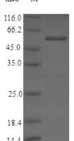 Human Cytochrome P450 11B2, mitochondrial (CYP11B2) Recombinant Protein, N-His, aa 25–503, Yeast - BioCrest Sci