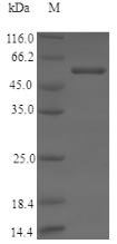 Human Cytochrome P450 11B2, mitochondrial (CYP11B2) Recombinant Protein, N-His, aa 25–503, Yeast, Homo sapiens (Human), Yeast, N-terminal 6xHis-tagged, 57.0 kDa, purity >≥ 90% as determined by SDS-PAGE.
