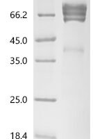 Mouse Coagulation factor IX (F9) Recombinant Protein - BioCrest Sci