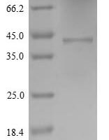 Human Cytochrome b-245 heavy chain (CYBB), partial Recombinant Protein - BioCrest Sci