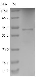 Human Cytochrome b-245 heavy chain (CYBB), partial Recombinant Protein, Homo sapiens (Human), Yeast, N-terminal 6xHis-tagged, 35.2 kDa, purity >≥ 90% as determined by SDS-PAGE.