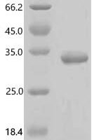Drosophila melanogaster Cilia- and flagella-associated protein 20 (Bug22) Recombinant Protein - BioCrest Sci