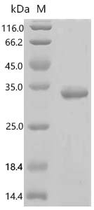 Drosophila melanogaster Cilia- and flagella-associated protein 20 (Bug22) Recombinant Protein, Drosophila melanogaster (Fruit fly), E.coli, C-terminal 6xHis-tagged, 30.2 kDa, purity >≥ 85% as determined by SDS-PAGE.