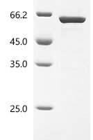 Human Signal recognition particle subunit SRP54 (SRP54) Recombinant Protein, C-His - BioCrest Sci