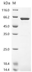 Human Signal recognition particle subunit SRP54 (SRP54) Recombinant Protein, C-His, Homo sapiens (Human), E.coli, C-terminal 6xHis-tagged, 62.6 kDa, purity >≥ 90% as determined by SDS-PAGE.