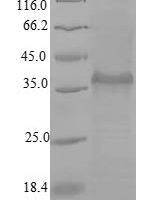 Macaca mulatta Chemokine CCL20/MIP-3ALPHA (CCL20) Recombinant Protein, N-GST - BioCrest Sci