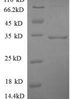 Human Succinate dehydrogenase [ubiquinone] flavoprotein subunit, mitochondrial (SDHA), partial Recombinant Protein, N-GST - BioCrest Sci