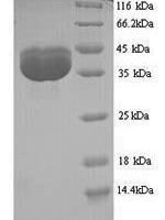 JC polyomavirus Minor capsid protein VP2 Recombinant Protein - BioCrest Sci