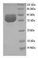 JC polyomavirus Minor capsid protein VP2 Recombinant Protein, JC polyomavirus (JCPyV) (JCV), Yeast, N-terminal 6xHis-tagged, 39.2 kDa, purity >≥ 90% as determined by SDS-PAGE.