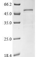 Saccharomyces cerevisiae Adenosylmethionine-8-amino-7-oxononanoate aminotransferase (BIO3) Recombinant Protein - BioCrest Sci