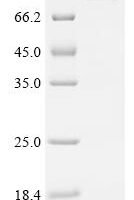 Human Z-DNA-binding protein 1 (ZBP1), Biotinylated Recombinant Protein - BioCrest Sci