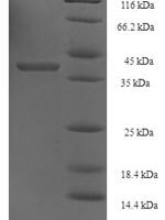 Saccharomyces cerevisiae DNA repair and recombination protein RAD52 (RAD52), partial Recombinant Protein - BioCrest Sci