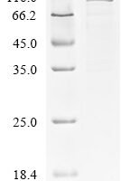 Human Gelsolin (GSN) Recombinant Protein, N-His - BioCrest Sci