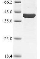 Rubella virus Structural polyprotein, partial Recombinant Protein - BioCrest Sci