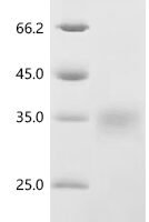 Macaca mulatta Erythropoietin (EPO) Recombinant Protein, C-10His - BioCrest Sci