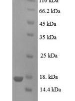 Human Prolactin-inducible protein (PIP) Recombinant Protein, N-His - BioCrest Sci