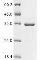 Human SUN domain-containing protein 3 (SUN3), partial Recombinant Protein - BioCrest Sci