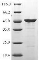 Human Immunity-related GTPase family M protein (IRGM) Recombinant Protein - BioCrest Sci