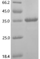 Human Leucine-rich repeat-containing G-protein coupled receptor 4 (LGR4), partial Recombinant Protein, C-His, aa 25–300 - BioCrest Sci