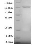 Human Cytoplasmic domain polyadenylation element-binding protein 1 (CPEB1) Recombinant Protein - BioCrest Sci
