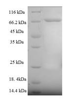 Human Cytoplasmic domain polyadenylation element-binding protein 1 (CPEB1) Recombinant Protein, Homo sapiens (Human), E.coli, N-terminal 6xHis-SUMO-tagged, 69.6 kDa, purity >≥ 90% as determined by SDS-PAGE.