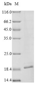 Macaca fascicularis Tumor necrosis factor ligand superfamily member 6 (FASLG), partial Recombinant Protein, Macaca fascicularis (Crab-eating macaque) (Cynomolgus monkey), in vitro E.coli expression system, N-terminal 6xHis-tagged, 18.5 kDa, purity >≥ 85% as determined by SDS-PAGE.