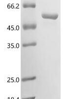 Mouse Nitric oxide synthase, inducible (Nos2), partial Recombinant Protein - BioCrest Sci