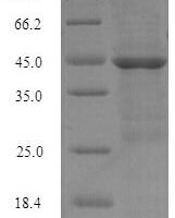 Human Hyaluronan-binding protein 2 (HABP2), partial Recombinant Protein, N-His-SUMO, aa 314–560 - BioCrest Sci