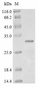 Pantoea stewartii subsp. stewartii Transcriptional activator protein esaR (esaR) Recombinant Protein, Pantoea stewartii subsp. stewartii (Erwinia stewartii), Yeast, C-terminal 6xHis-tagged, 29.6 kDa, purity >≥ 85% as determined by SDS-PAGE.