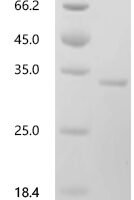 Human HLA class II histocompatibility antigen, DP beta 1 chain (HLA-DPB1), partial Recombinant Protein, C-His - BioCrest Sci
